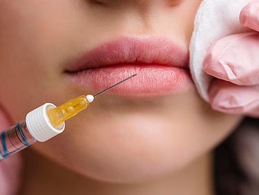 lippenkorrektur-title.jpg
