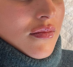 Lippenästhetik - 15