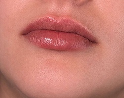 Lippenästhetik - 1